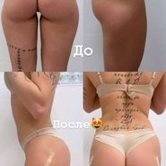 Слив Анны Михеевой