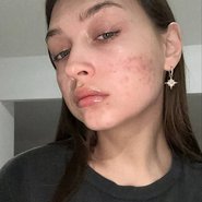 Слив Ностянки