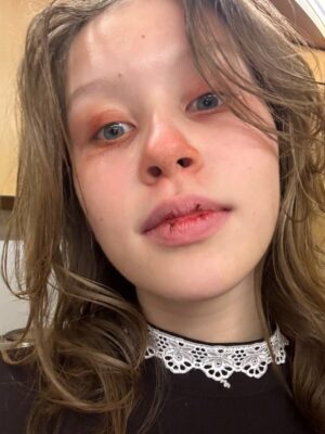 Анна Пересильд